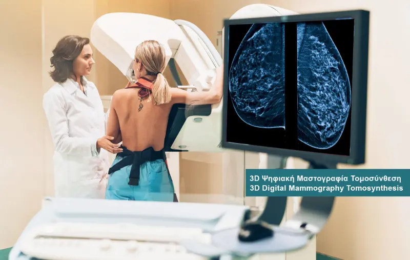Mammography and Tomosynthesis examination at DIKTEON Medical Diagnostic Center in Strovolos - Nicosia - Cyprus